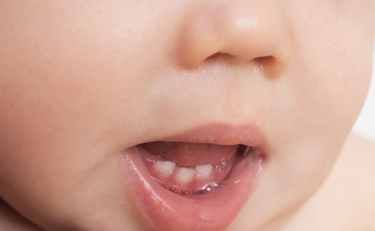 Когда и как появляются зубы? Что делать, если ребенок родился с зубами? Средние сроки прорезывания молочных зубов. 